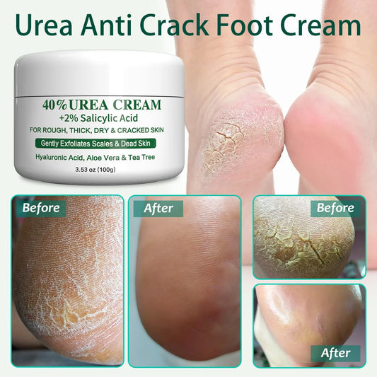 100g Urea Anti Crack Foot Cream